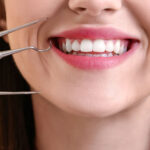 How Much Does It Cost to Get Wisdom Teeth Removed in Australia?